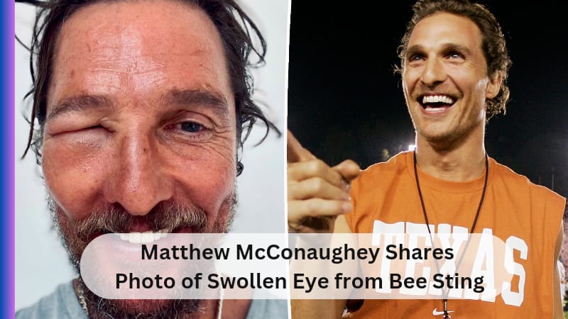 Matthew McConaughey Shares Photo of Swollen Eye from Bee Sting, Fans Express Concern