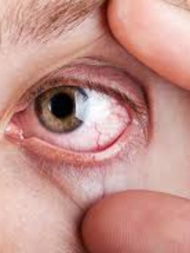 Save Your Eyes! 6 Easy Tips for Screen Time Survival