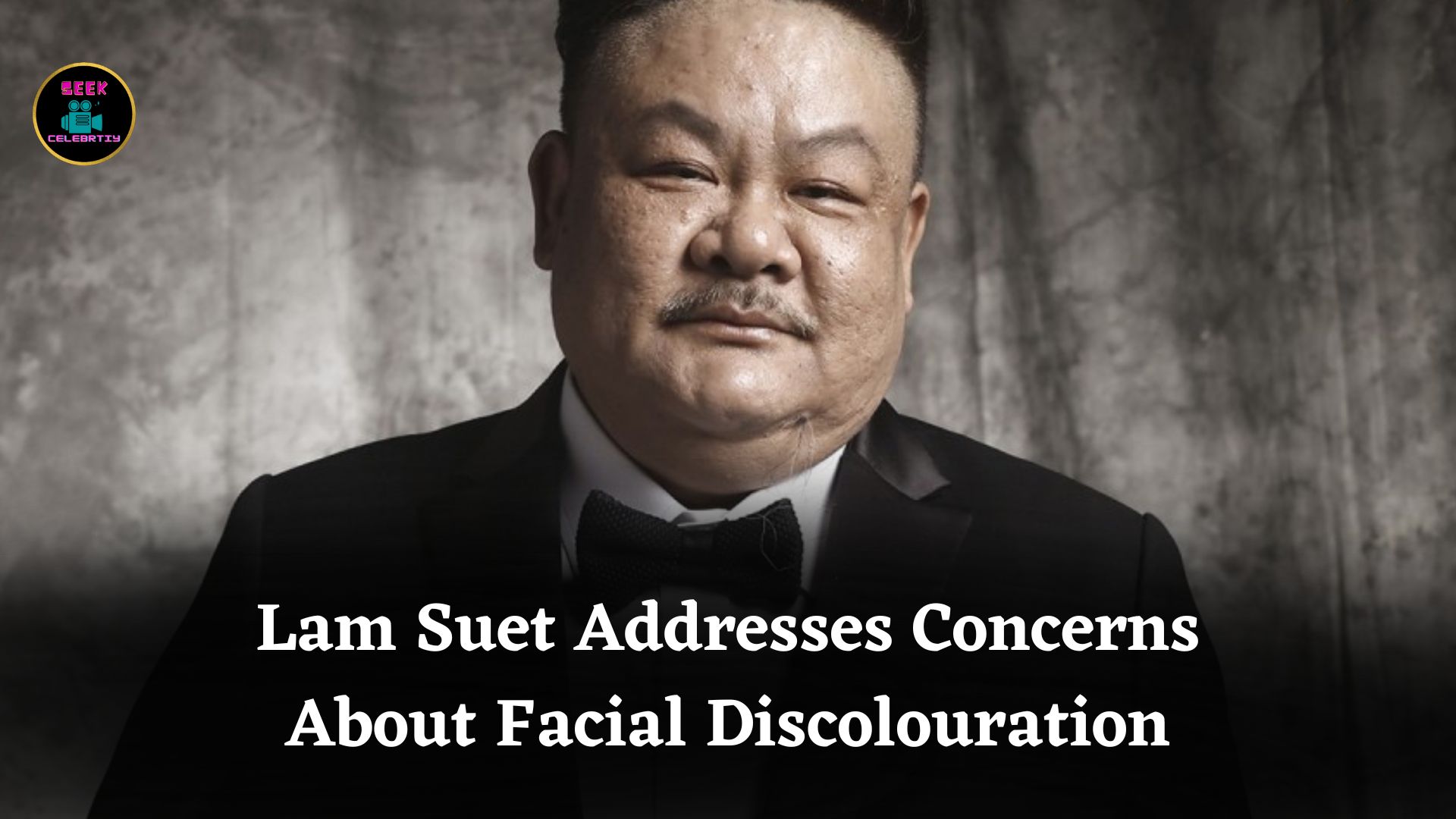 Lam Suet Addresses Rising Concerns Over Facial Discolouration and Reveals Possible Underlying Causes